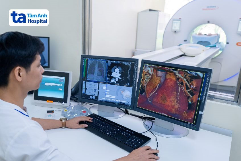 sieu-may-chup-ct-100000-lat-cat.jpg