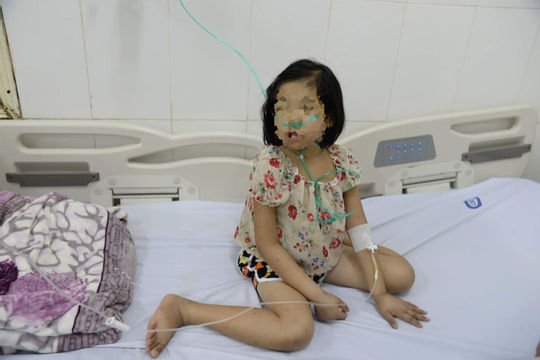 Cứu sống bệnh nhân Thalassemia 12 tuổi bị Đái tháo đường hiếm gặp