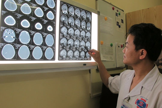 Bệnh nhân hồi phục  kỳ diệu sau ca mổ não nhiều rủi ro