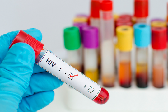 Đa dạng hóa các mô hình xét nghiệm, sàng lọc HIV