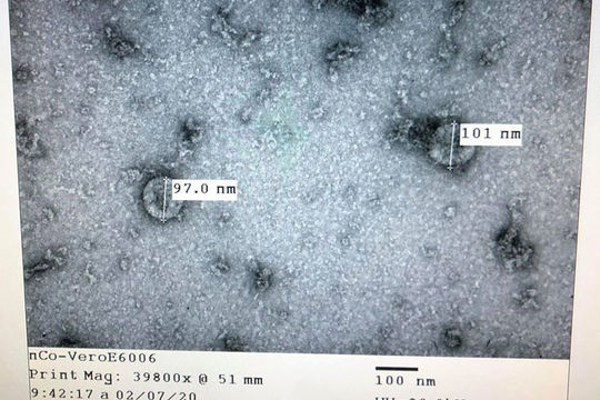 Việt Nam tiến hành thử nghiệm thuốc điều trị nCoV